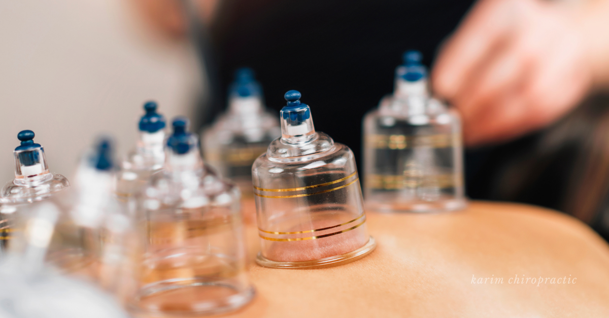 Read more about the article Benefits of Cupping Therapy Combined with Chiropractic