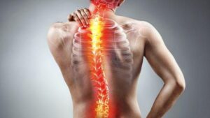 Read more about the article How Chiropractic Can Help You with Scoliosis Pain