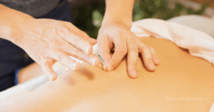 Read more about the article Acupuncture in Downtown Overland Park