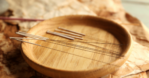 Read more about the article Benefits of Acupuncture for Pain and Stress Relief in Overland Park