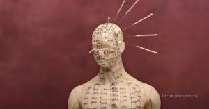 Read more about the article Why Acupuncture Is Becoming a Top Choice for Holistic Care in Downtown Overland Park