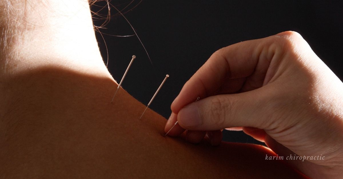 Acupuncture treatment supporting long-term wellness and relief